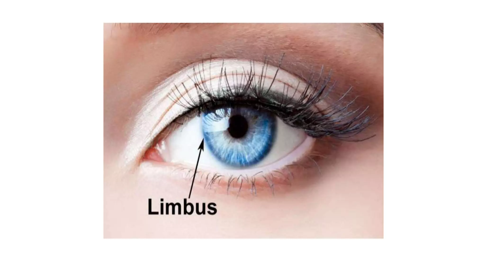 Limbus PPT