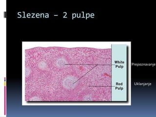 Slezena – 2 pulpe

Prepoznavanje

Uklanjanje

 
