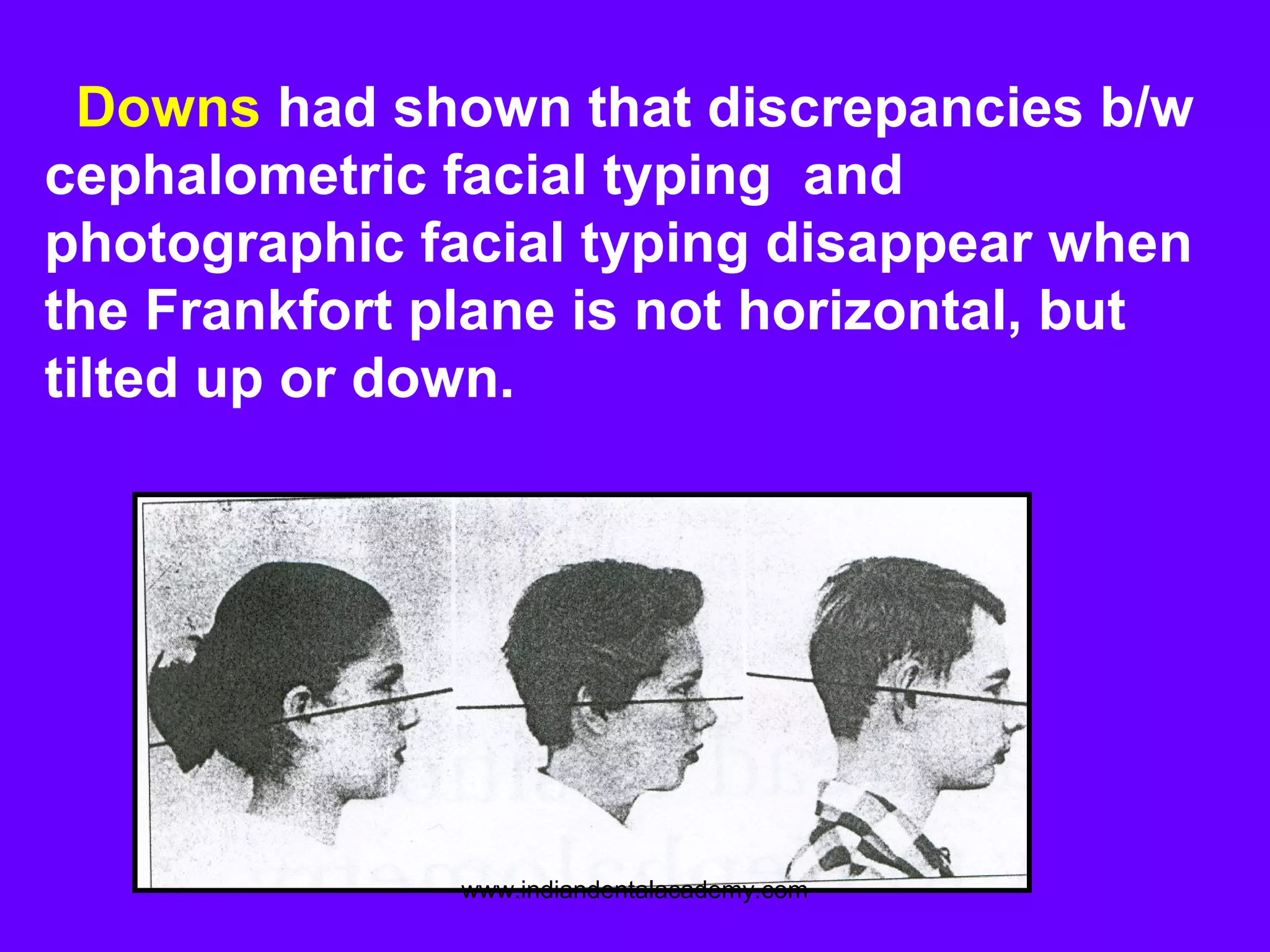 Downs had shown that discrepancies b/w
cephalometric facial typing and
photographic facial typing disappear when
the Frankfort plane is not horizontal, but
tilted up or down.
www.indiandentalacademy.com
 