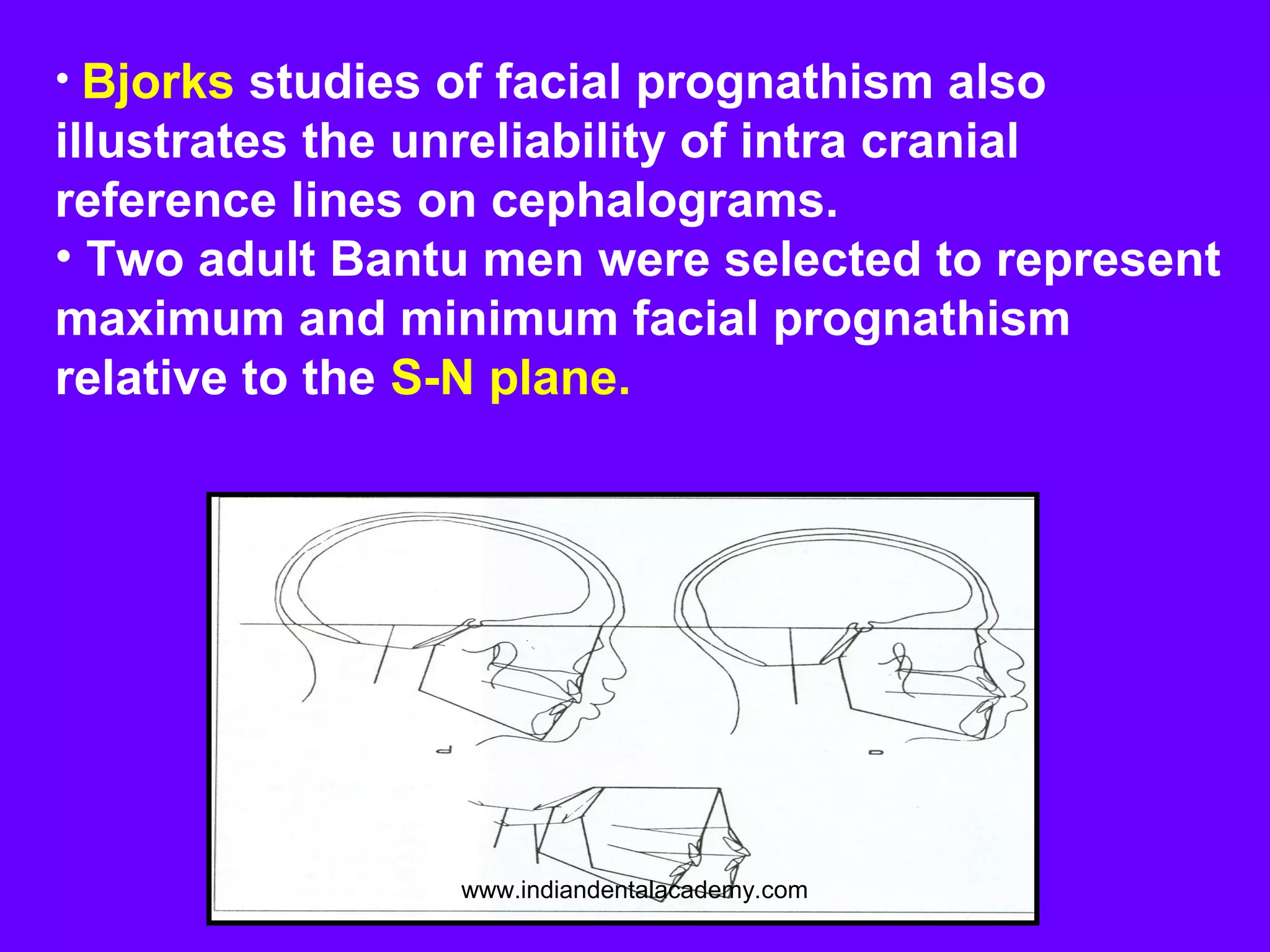 • Bjorks studies of facial prognathism also
illustrates the unreliability of intra cranial
reference lines on cephalograms.
• Two adult Bantu men were selected to represent
maximum and minimum facial prognathism
relative to the S-N plane.
www.indiandentalacademy.com
 