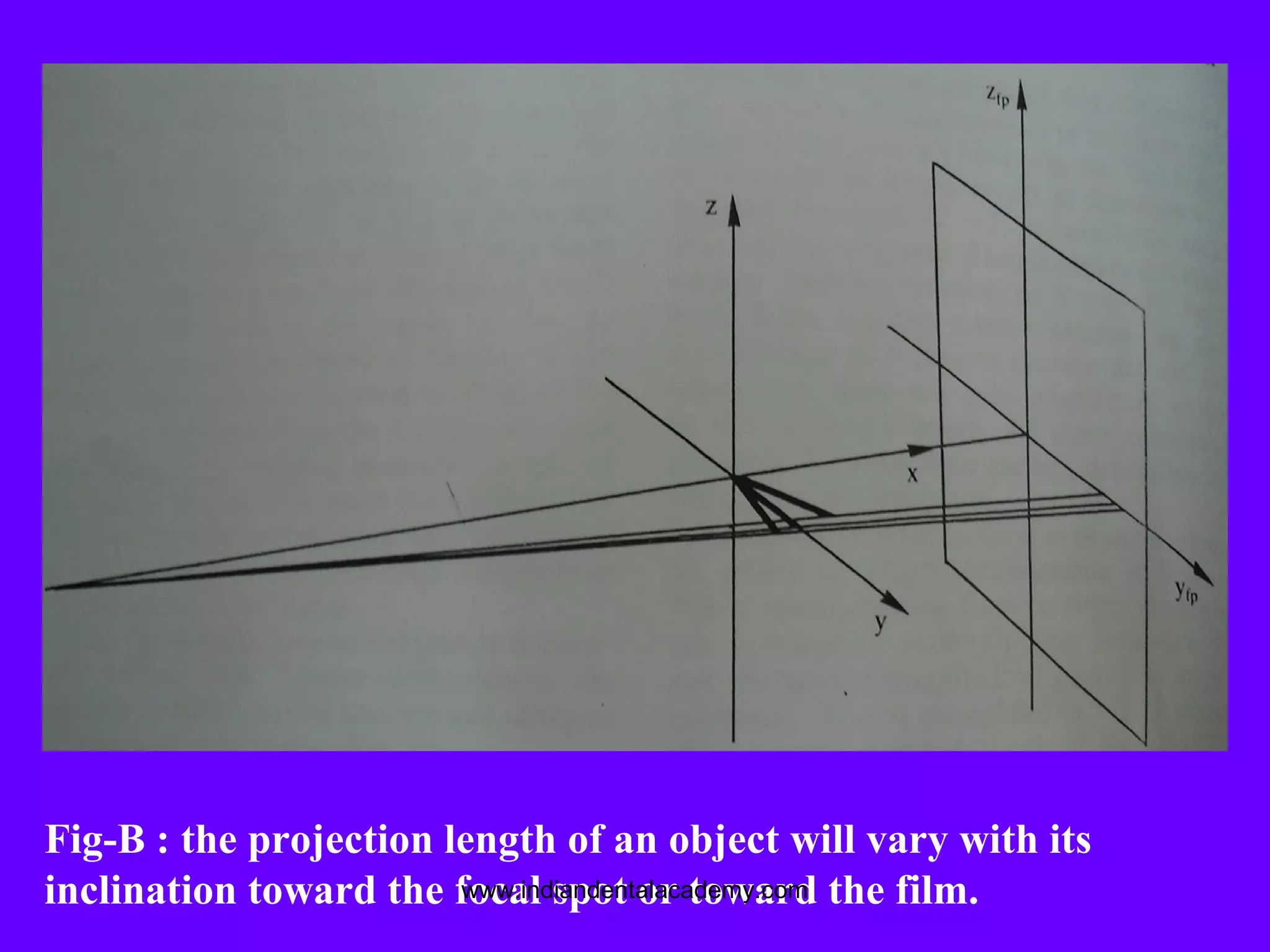 Fig-B : the projection length of an object will vary with its
inclination toward the focal spot or toward the film.www.indiandentalacademy.com
 