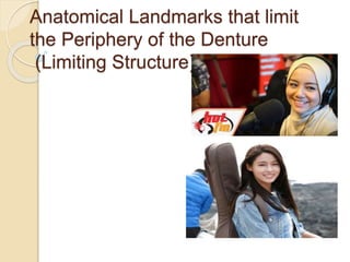 Anatomical Landmarks that limit
the Periphery of the Denture
(Limiting Structure)
 