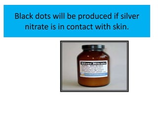 Black dots will be produced if silver
nitrate is in contact with skin.
 