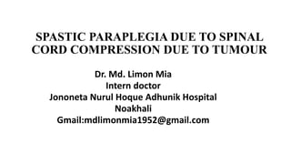 SPASTIC PARAPLEGIA DUE TO SPINAL
CORD COMPRESSION DUE TO TUMOUR
Dr. Md. Limon Mia
Intern doctor
Jononeta Nurul Hoque Adhunik Hospital
Noakhali
Gmail:mdlimonmia1952@gmail.com
 