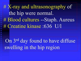 # X-ray and ultrasonography of 
the hip were normal. 
# Blood cultures --Staph. Aureus 
# Creatine kinase :636 U/l 
On 3rd day found to have diffuse 
swelling in the hip region 
 