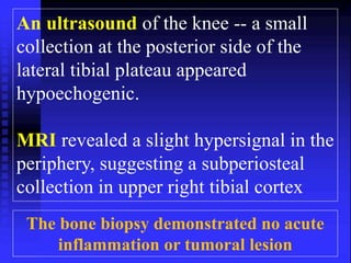 An ultrasound of the knee -- a small 
collection at the posterior side of the 
lateral tibial plateau appeared 
hypoechogenic. 
MRI revealed a slight hypersignal in the 
periphery, suggesting a subperiosteal 
collection in upper right tibial cortex 
The bone biopsy demonstrated no acute 
inflammation or tumoral lesion 
 