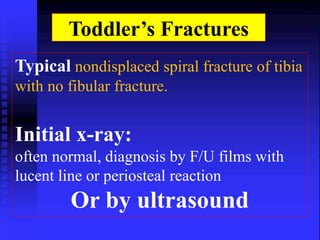 Toddler’s Fractures 
Typical nondisplaced spiral fracture of tibia 
with no fibular fracture. 
Initial x-ray: 
often normal, diagnosis by F/U films with 
lucent line or periosteal reaction 
Or by ultrasound 
 