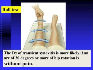 Roll test 
The Dx of transient synovitis is more likely if an 
arc of 30 degrees or more of hip rotation is 
without pain. 
 