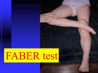 FABER test 
 