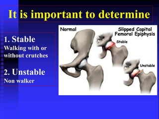 It is important to determine 
1. Stable 
Walking with or 
without crutches 
2. Unstable 
Non walker 
 