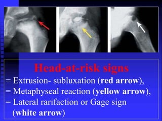 Head-at-risk signs 
= Extrusion- subluxation (red arrow), 
= Metaphyseal reaction (yellow arrow), 
= Lateral rarifaction or Gage sign 
(white arrow) 
 