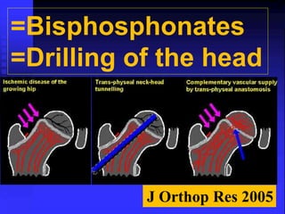 =Bisphosphonates 
=Drilling of the head 
J Orthop Res 2005 
 