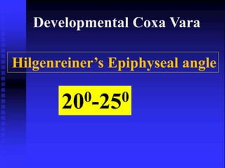 Developmental Coxa Vara 
Hilgenreiner’s Epiphyseal angle 
200-250 
 