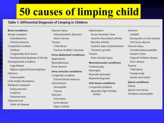 50 causes of limping child 
 