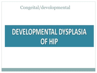 Congeital/devolopmental
 