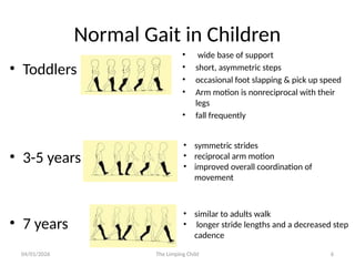 approching to a limping child and common presntation .pptx