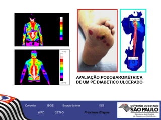 27,0°C
37,0°C
AR01
27,0°C
37,0°C
AR01
AR02
AVALIAÇÃO PODOBAROMÉTRICA
DE UM PÉ DIABÉTICO ULCERADO
Conceito IBGE Estado da Arte ISO
WRD CETI-D Próximas Etapas
 