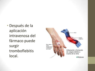 • Después de la
aplicación
intravenosa del
fármaco puede
surgir
tromboflebitis
local.

 