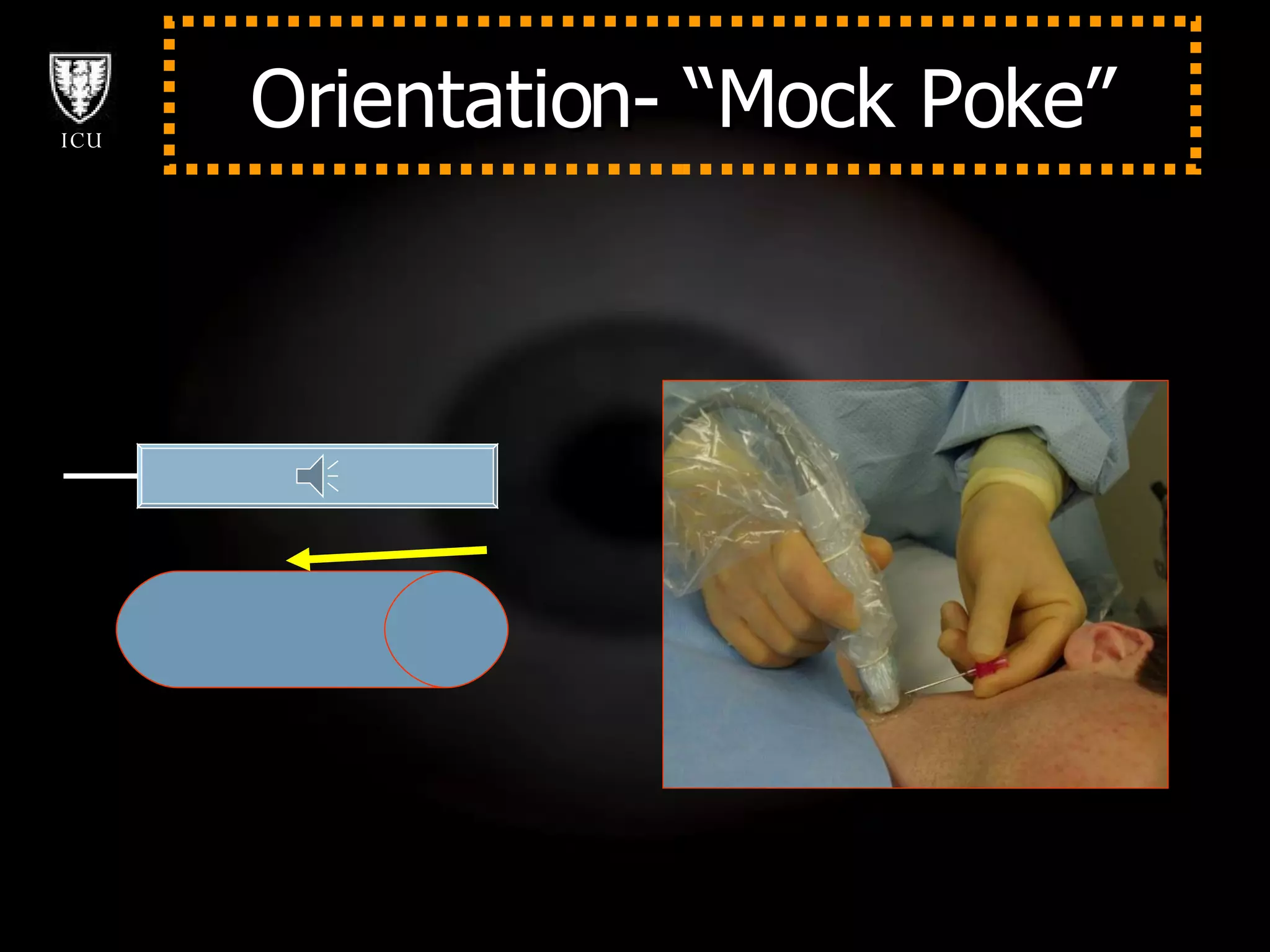Orientation- “Mock Poke” 
