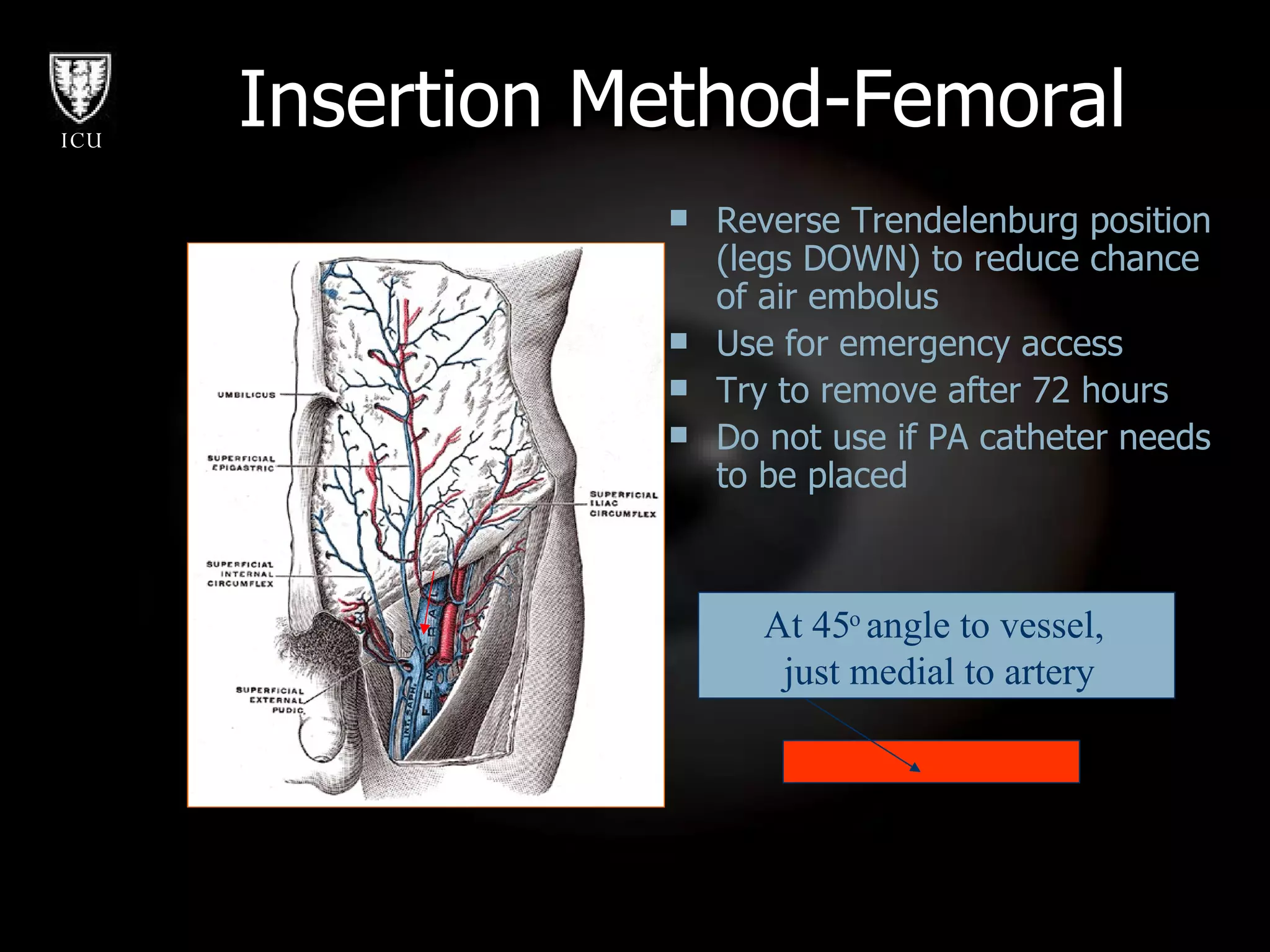 Reverse Trendelenburg position (legs DOWN) to reduce chance of air embolus Use for emergency access Try to remove after 72 hours Do not use if PA catheter needs to be placed Insertion Method-Femoral At 45 o  angle to vessel,  just medial to artery 