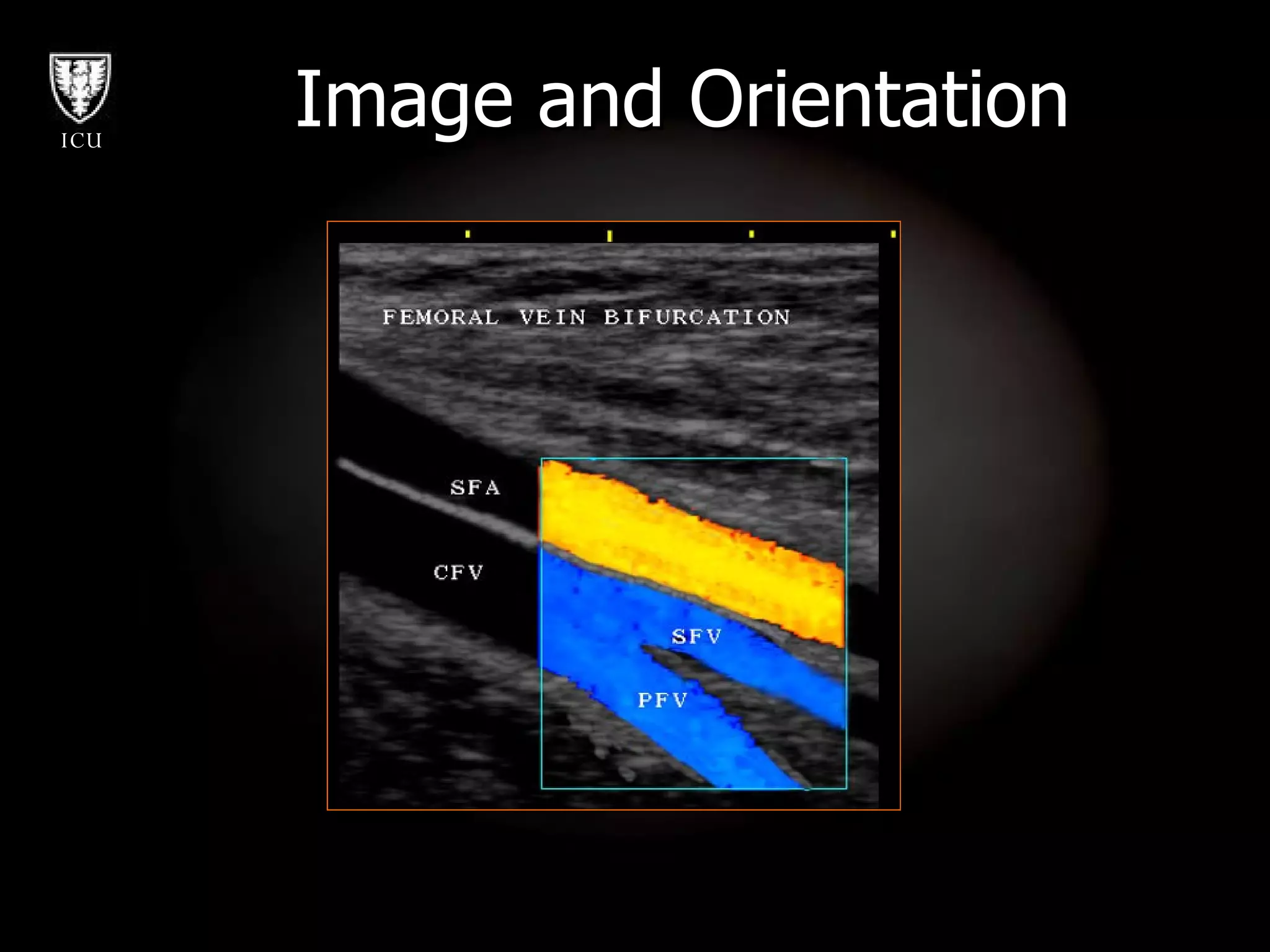 Image and Orientation 