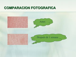 COMPARACION FOTOGRAFICA Antes Después de 1 semana 