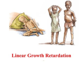 Linear Growth Retardation
 