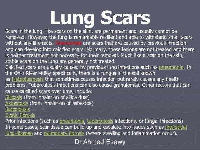 Linear lung density x ray Dr Ahmed Esawy