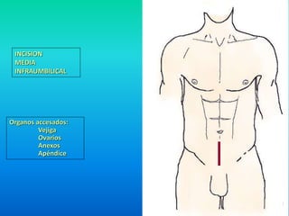 INCISION 
MEDIA 
INFRAUMBILICAL 
Organos accesados: 
Vejiga 
Ovarios 
Anexos 
Apéndice 
 