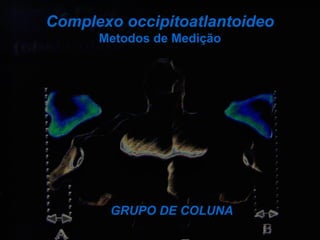 Complexo occipitoatlantoideo
Metodos de Medição
GRUPO DE COLUNA
 