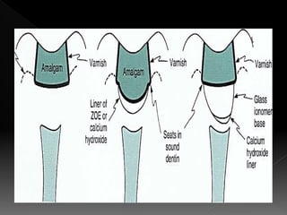 liners, Bases and varnish information dental | PPTX