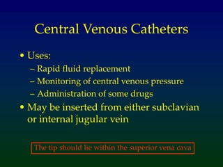 lines_and_tubes (2).ppt
