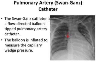 Swann Line Lines and tubes in xray | PPTX