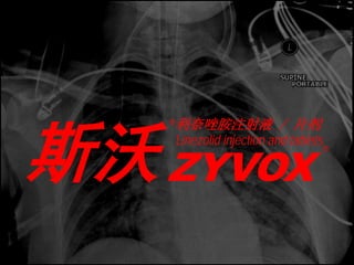 ®利奈唑胺注射液



斯沃 ZYVOX
                         / 片剂
    Linezolid injection and tablets
                                  ®
 