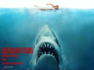 超级耐药菌
MRSA/MRSE
VRE
VISA/GISA/VRSA
……
 