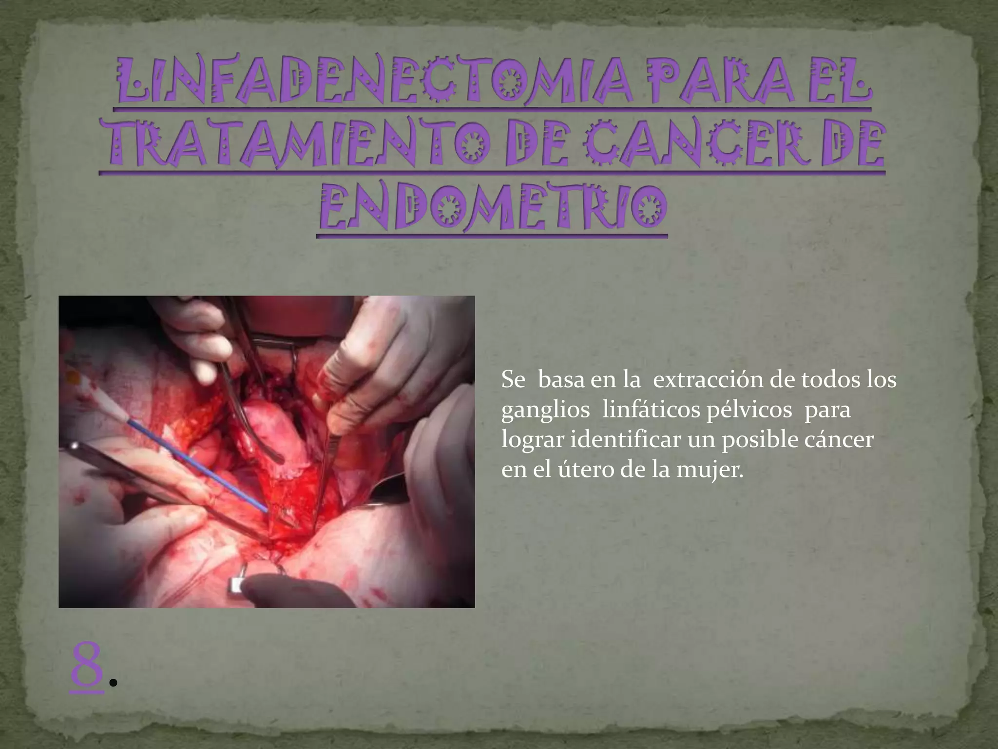 Se basa en la extracción de todos los
     ganglios linfáticos pélvicos para
     lograr identificar un posible cáncer
     en el útero de la mujer.




8.
 