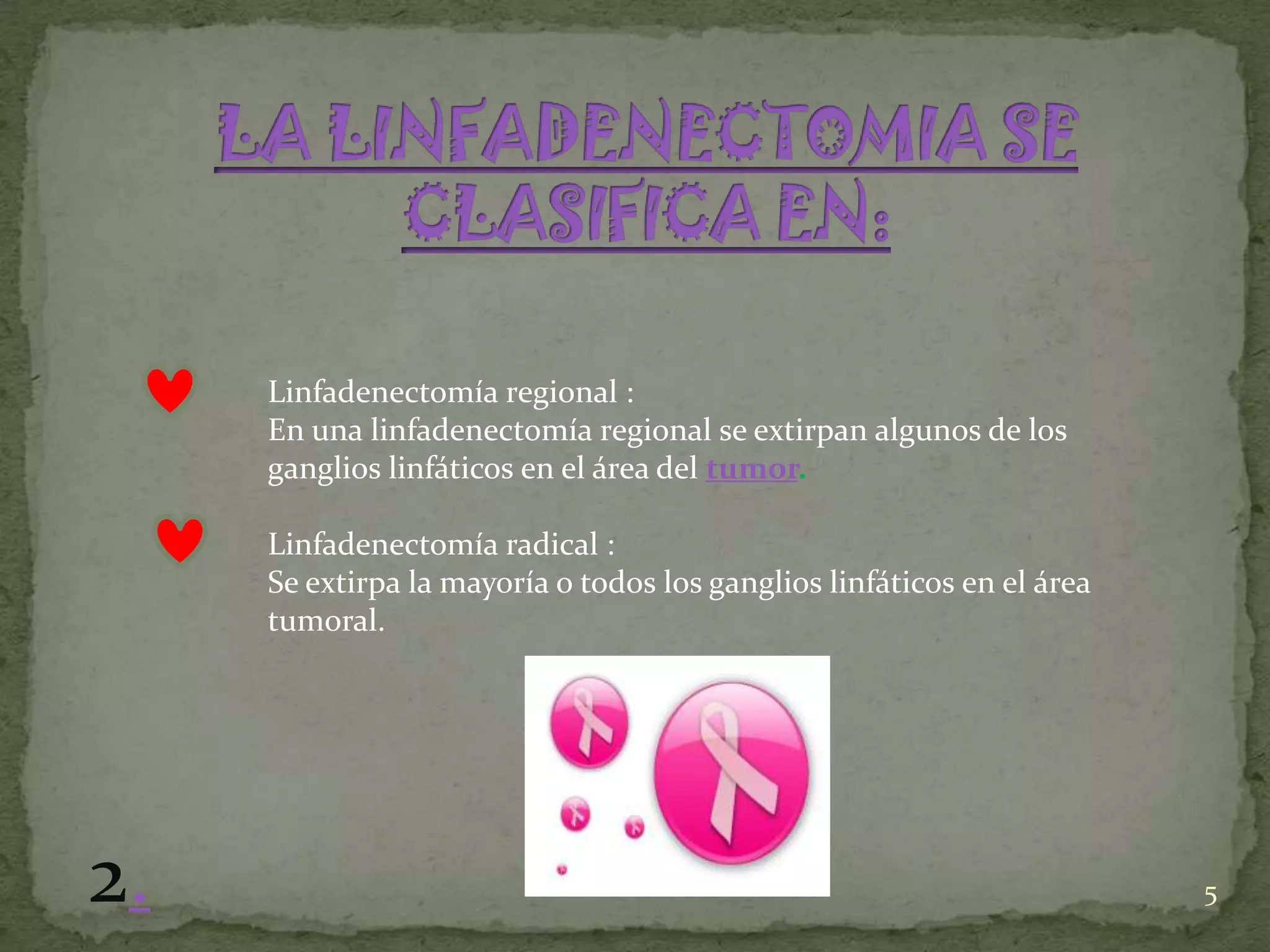 Linfadenectomía regional :
     En una linfadenectomía regional se extirpan algunos de los
     ganglios linfáticos en el área del tumor.

     Linfadenectomía radical :
     Se extirpa la mayoría o todos los ganglios linfáticos en el área
     tumoral.




2.                                                                      5
 