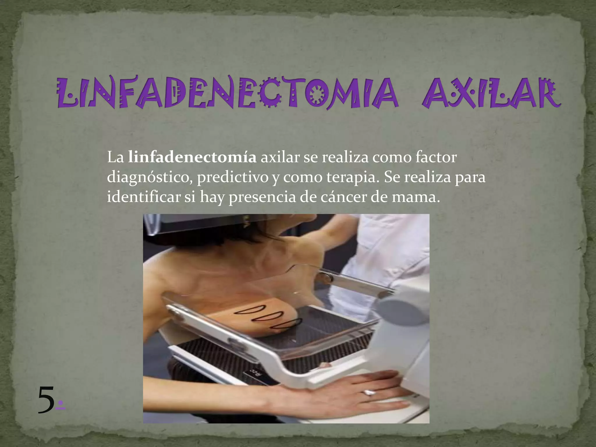La linfadenectomía axilar se realiza como factor
     diagnóstico, predictivo y como terapia. Se realiza para
     identificar si hay presencia de cáncer de mama.




5.
 