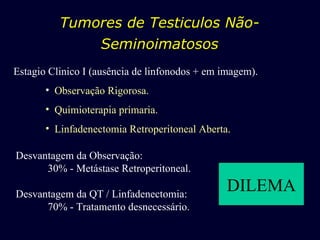 Tumores de Testiculos Não-Seminoimatosos Estagio Clinico I (ausência de linfonodos + em imagem). Observação Rigorosa. Quimioterapia primaria. Linfadenectomia Retroperitoneal Aberta. Desvantagem da Observação: 30% - Metástase Retroperitoneal. Desvantagem da QT / Linfadenectomia: 70% - Tratamento desnecessário. DILEMA 