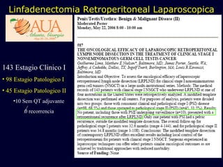 Linfadenectomia Retroperitoneal Laparoscopica 143 Estagio Clinico I 98 Estagio Patologico I 45 Estagio Patologico II 10 Sem QT adjuvante 0 recorrencia 