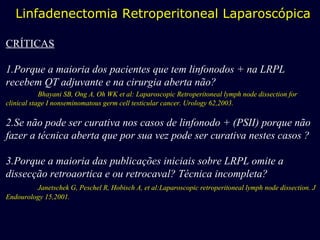 Linfadenectomia Retroperitoneal Laparoscópica CRÍTICAS 1.Porque a maioria dos pacientes que tem linfonodos + na LRPL recebem QT adjuvante e na cirurgia aberta não? Bhayani SB, Ong A, Oh WK et al: Laparoscopic Retroperitoneal lymph node dissection for clinical stage I nonseminomatous germ cell testicular cancer. Urology 62,2003. 2.Se não pode ser curativa nos casos de linfonodo + (PSII) porque não fazer a técnica aberta que por sua vez pode ser curativa nestes casos ? 3.Porque a maioria das publicações iniciais sobre LRPL omite a dissecção retroaortica e ou retrocaval? Técnica incompleta? Janetschek G, Peschel R, Hobisch A, et al:Laparoscopic retroperitoneal lymph node dissection. J Endourology 15,2001. 