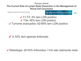 ✔ Radiologia: 32-43% linfonodos >1cm são realmente meta
✔ T1-T2: 4% tem LDN positivo
✔ T3a: 46% tem LDN positivo
✔ Tumores avançados: 62-66% tem LDN positivo
Review Article
The Current Role of Lymph Node Dissection in the Management of
Renal Cell Carcinoma
Joseph E Jamal and Thomas W Jarrett
2011
✔ 3-10% tem apenas linfonodo
 