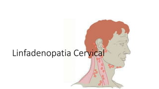 Linfadenopatia Cervical
 