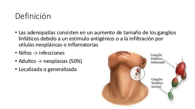 Linfadenopatia Cervical Completa