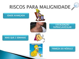 IDADE AVANÇADA
LOCALIZAÇÃO
SUPRACLAVICULAR
FIRMEZA DO NÓDULO
MAIS QUE 2 SEMANAS
 