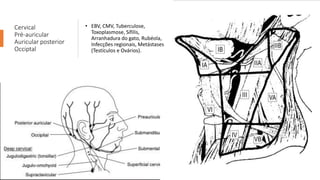 Cervical
Pré-auricular
Auricular posterior
Occiptal
• EBV, CMV, Tuberculose,
Toxoplasmose, Sífilis,
Arranhadura do gato, Rubéola,
Infecções regionais, Metástases
(Testículos e Ovários).
 