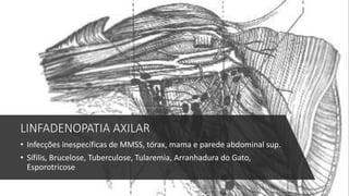 LINFADENOPATIA AXILAR
• Infecções inespecíficas de MMSS, tórax, mama e parede abdominal sup.
• Sífilis, Brucelose, Tuberculose, Tularemia, Arranhadura do Gato,
Esporotricose
 