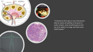 “It showed its first signs in men and women
alike by means of swelling in the groin or
under armpits, some of which grew to the
size of an apple or an egg, and these were
called buboes.”
 