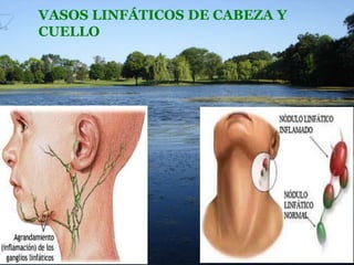 VASOS LINFÁTICOS DE CABEZA Y
CUELLO

 