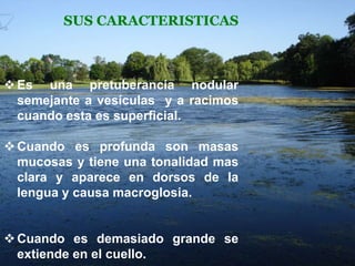 SUS CARACTERISTICAS

 Es una pretuberancia nodular
semejante a vesículas y a racimos
cuando esta es superficial.

 Cuando es profunda son masas
mucosas y tiene una tonalidad mas
clara y aparece en dorsos de la
lengua y causa macroglosia.
 Cuando es demasiado grande se
extiende en el cuello.

 